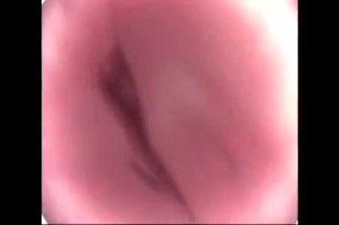 Japanese Mouthcam and Gagging - 1